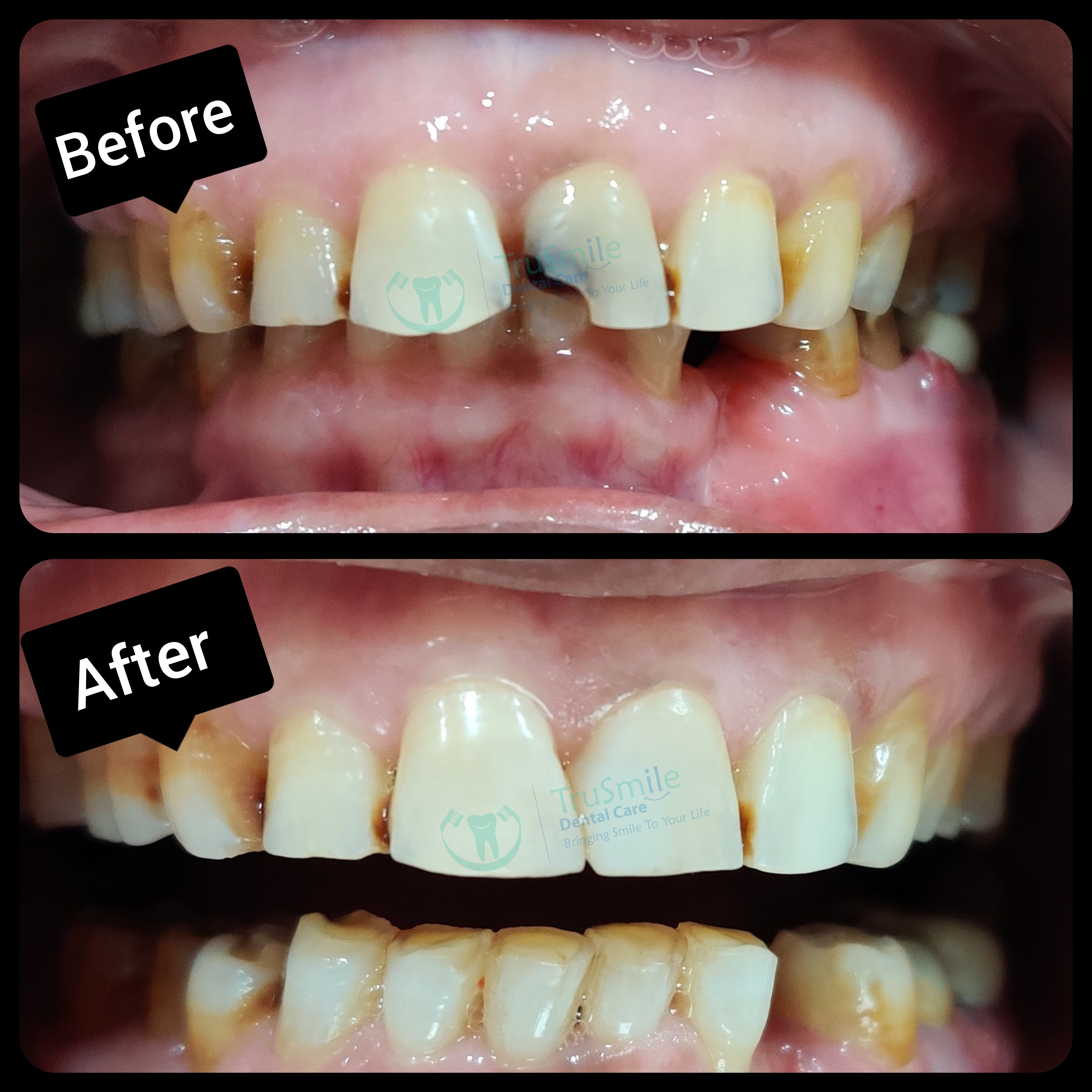 Smile Design 3